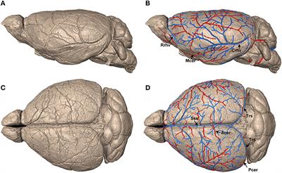 Precise Cerebral Vascular Atlas in Stereotaxic Coordinates of Whole Mouse Brain